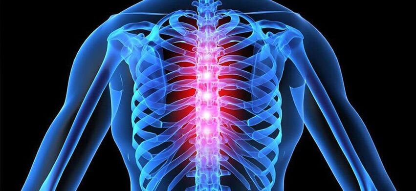 Ο οξύς πόνος είναι χαρακτηριστικός της έξαρσης της οστεοχόνδρωσης της θωρακικής σπονδυλικής στήλης