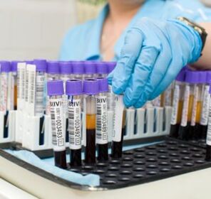 Εξέταση αίματος για τη διάγνωση του πόνου στις αρθρώσεις