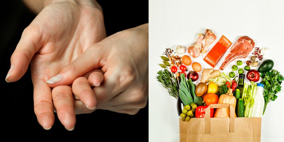 Ουρική αρθρίτιδα των χεριών και τρόφιμα για τη θεραπεία τους